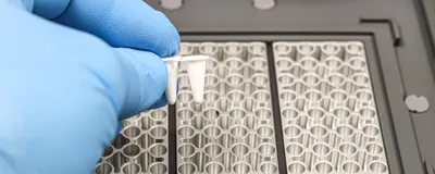 Streamlining Gene Expression Analysis From Cells to RT-qPCR