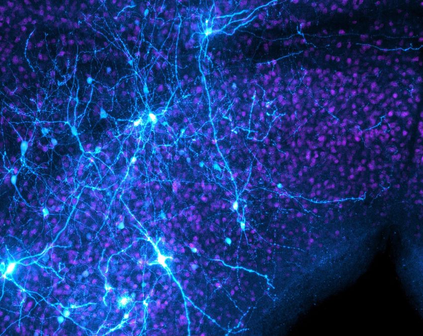 An image that shows brain cells in blue and pink.