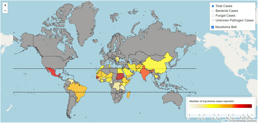 A map of the world showing the global distribution of mycetoma cases.