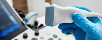 Ultrasound scanner probe in doctor's hand.