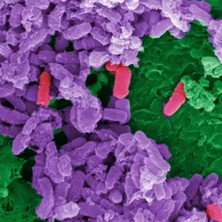 A scanning electron micrograph of bacterial biofilms attached to vaginal epithelium, sampled from a Human Microbiome Project participant.