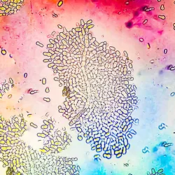 Fungi under the microscope, representing the mycobiome.