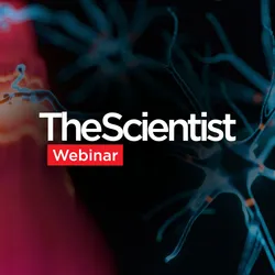 Rethinking ALS Biomarkers: From Discovery to Clinical Impact
