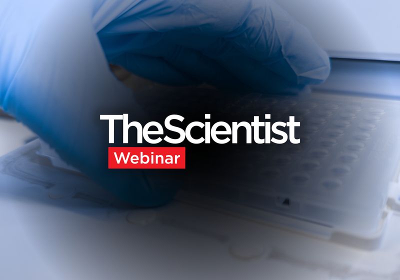Best Practices for qPCR Assay Design and Optimization