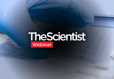 Best Practices for qPCR Assay Design and Optimization