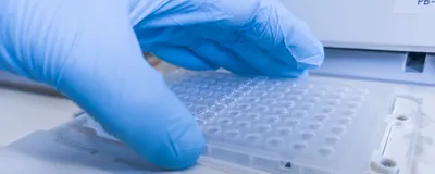 Best Practices for qPCR Assay Design and Optimization