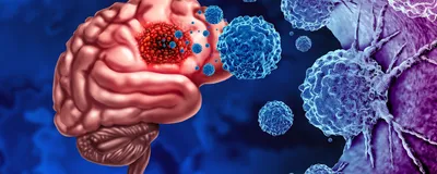 Engineering CAR-Neutrophils In Vivo to Target Glioblastoma