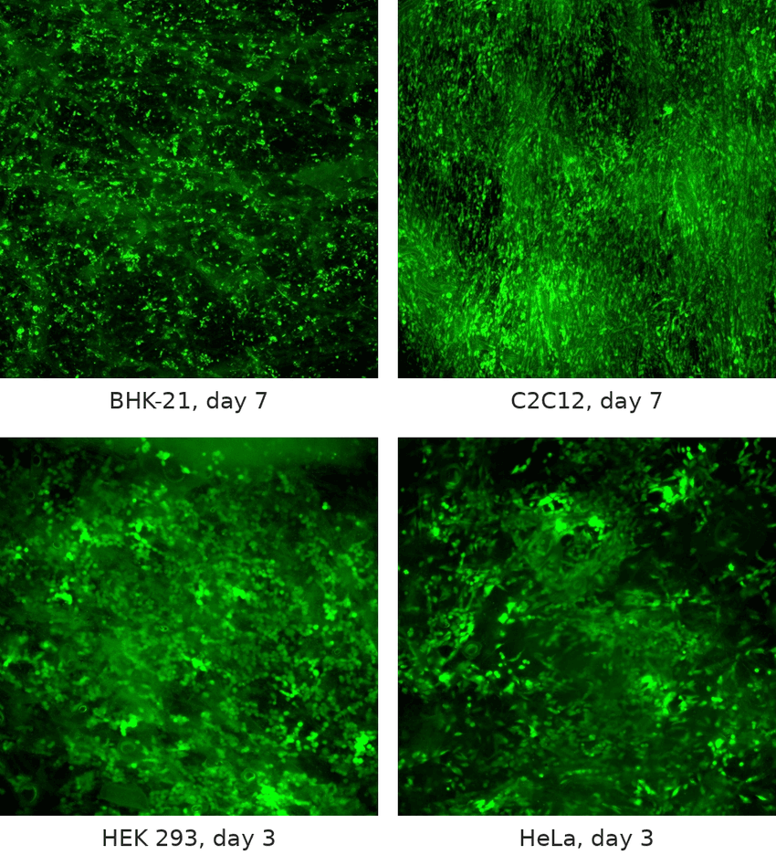 Four fluorescence microscopy panels arranged in a square. Four fluorescence microscopy panels arranged in a square.