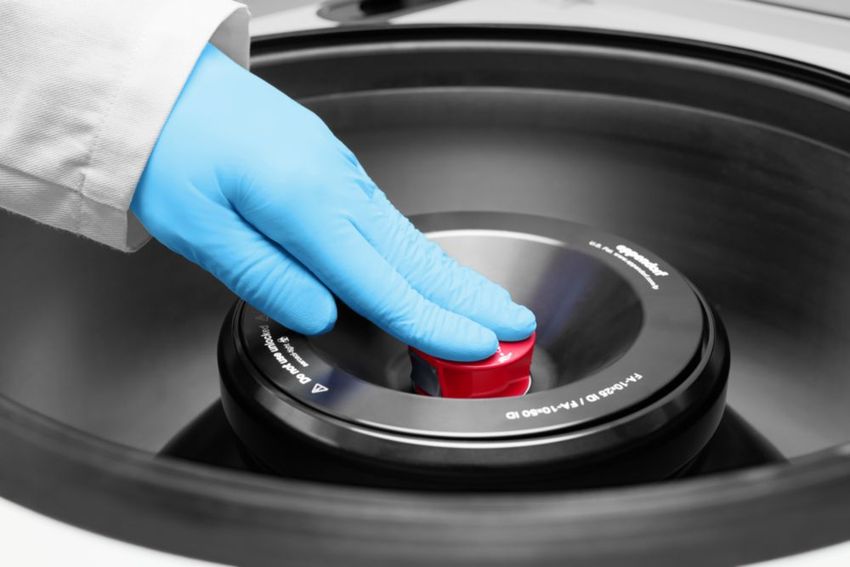 A researcher opening a centrifuge rotor lid