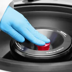 A researcher opening a centrifuge rotor lid