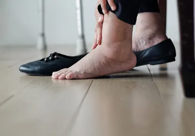 An older person with swollen feet massaging their ankle.