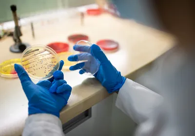Photograph of a scientist’s hands, covered in blue gloves, holding open a petri dish with bacterial colonies growing on them. 