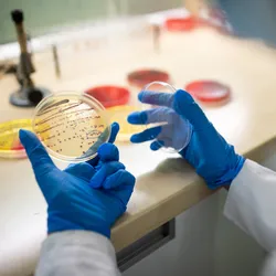 Photograph of a scientist’s hands, covered in blue gloves, holding open a petri dish with bacterial colonies growing on them. 