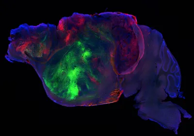 A side view of a mouse brain labelled with three distinct fluorescent proteins.