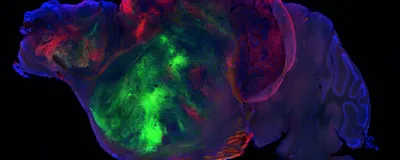 A side view of a mouse brain labelled with three distinct fluorescent proteins.
