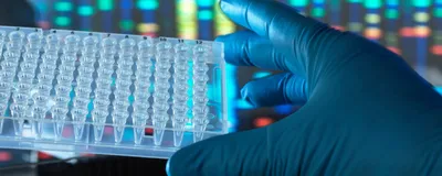 A scientist wearing a blue glove holds a 96-well plate in their hand. Metagenomic data is shown on the computer screen in the background.