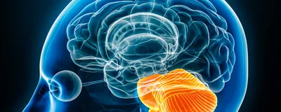 3D illustration of the brain with the hindbrain in orange.