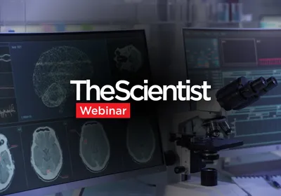 Quantifying CTE With Digital and Computational Pathology