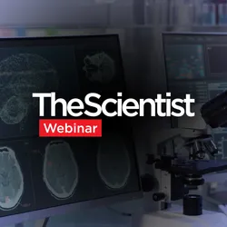 Quantifying CTE With Digital and Computational Pathology