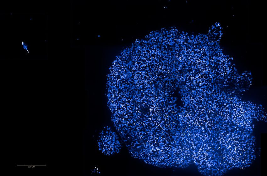 A few blue-colored cells against a black background, signifying cardiac organoids. A few blue-colored cells against a black background, signifying cardiac organoids.