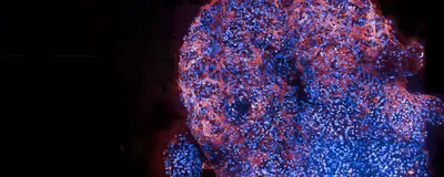 A few blue-colored cells with red-colored structures between them against a black background, signifying cardiac organoids.