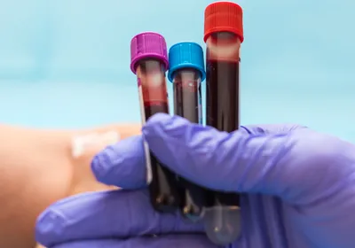 Image a gloved hand holding three blood tubes. From left to right, the tube top colors are purple, light blue, and red.