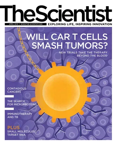 Infographic: CAR-T Cells in Solid Versus Liquid Cancers | The Scientist