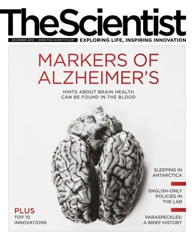 What Paraspeckles Can Teach Us About Basic Cell Biology | The Scientist